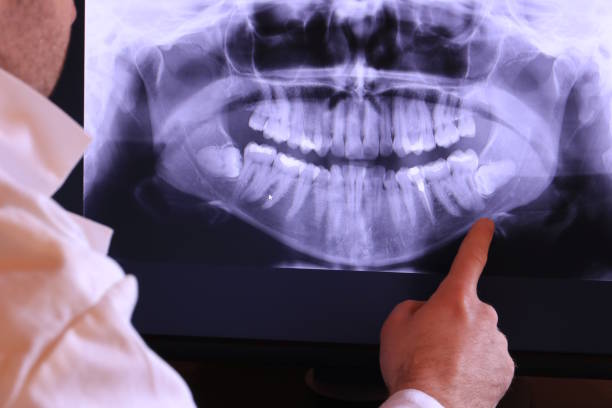 Best Emergency Dental Extractions in Waynesburg, PA